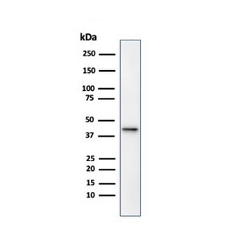 p504S Antibody / AMACR