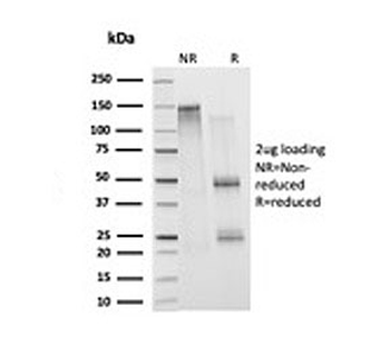 Histone Antibody / Histone H1