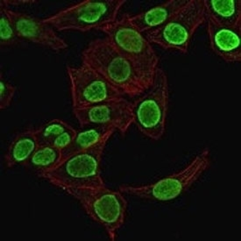 Histone Antibody / Histone H1
