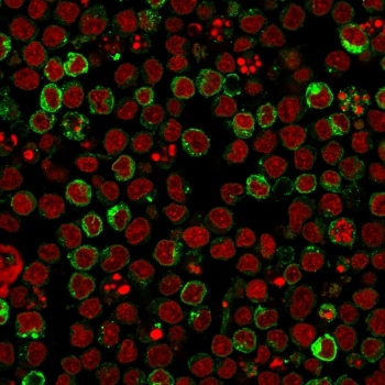 HLA-DR Antibody (MHC II)