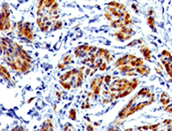 Recombinant CAD Antibody / CALD1 / Caldesmon (HMW)