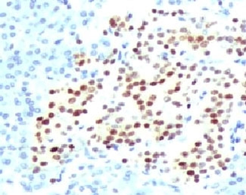 Recombinant NKX2.2 Antibody / Rabbit Monoclonal