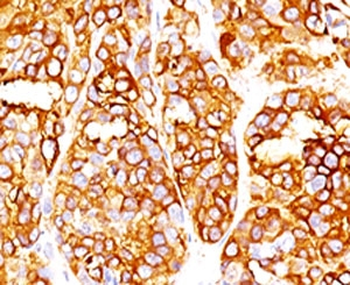 Recombinant MART-1 Antibody / Rabbit Monoclonal