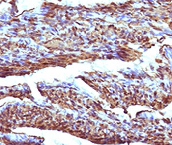 Recombinant Calponin Antibody / Rabbit Monoclonal