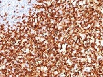 CD45RO Antibody
