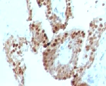 p57 Antibody