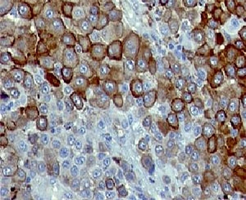 CD271 Antibody / NGFR / p75NTR
