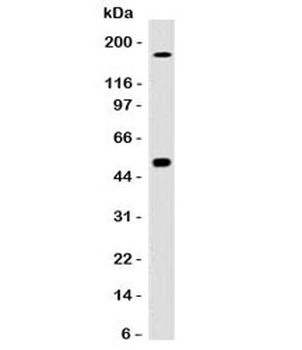 CAIX Antibody / Carbonic Anhydrase IX