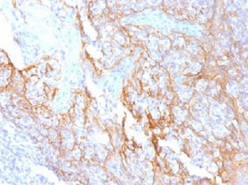 Beta Catenin Antibody