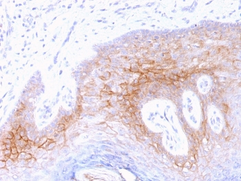 Desmocollin 2/3 Antibody