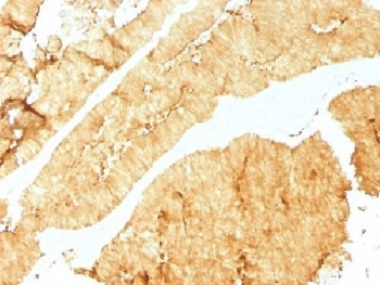 Villin Antibody / VIL1
