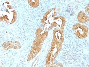 Villin Antibody / VIL1
