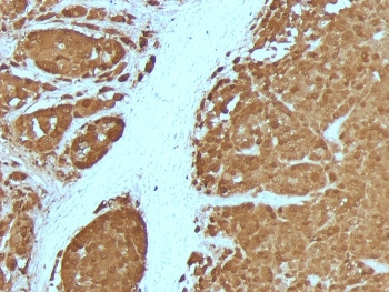 S100B Antibody Cocktail