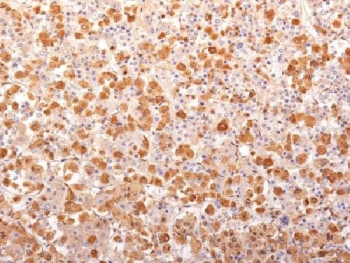 Recombinant ACTH Antibody / POMC N-Terminal