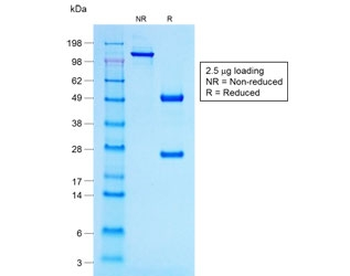 Recombinant ACTH Antibody / POMC N-Terminal