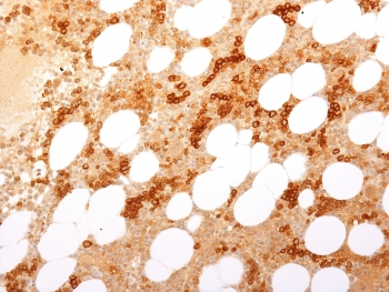 CD71 Antibody / Transferrin Receptor (Extracellular domain)