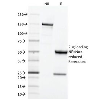 Transferrin Receptor Antibody / CD71 (Extracellular domain)