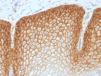 Recombinant CD44v4 Antibody / Rabbit Monoclonal