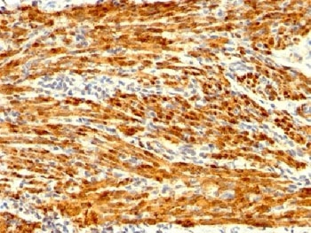 Recombinant Calponin Antibody / Rabbit Monoclonal