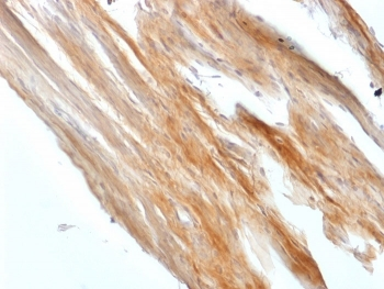 Recombinant Caldesmon Antibody / CALD1 / CAD (HMW)