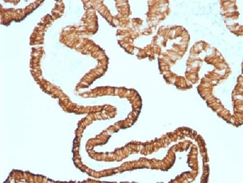 Recombinant Cytokeratin 7 Antibody / Rabbit Monoclonal