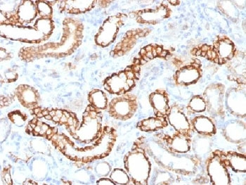 Recombinant Cadherin 16 Antibody / Rabbit Monoclonal