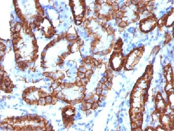 Recombinant Cadherin 16 Antibody / Rabbit Monoclonal