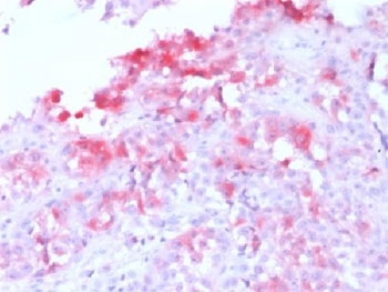 Recombinant Melan-A Antibody / Rabbit Monoclonal