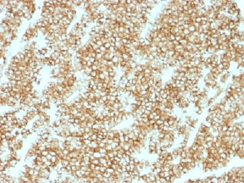 Recombinant PTH Antibody (N-Terminal) / Rabbit Monoclonal