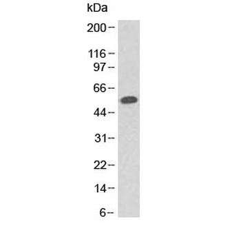 p53 Antibody (N-Terminal Region)
