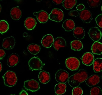 Recombinant CD45RB Antibody / Rabbit Monoclonal