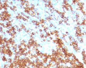 Recombinant CD45RB Antibody / Rabbit Monoclonal