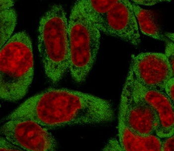 RPSA Antibody / 40S Ribosomal protein SA / Laminin Receptor 1
