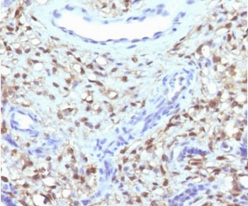 Recombinant S100A4 Antibody / FSP1
