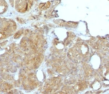 Recombinant MVP Antibody