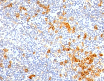 Recombinant IL3RA Antibody / CD123