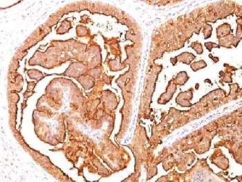 MUC1 Antibody / Mucin-1 / EMA