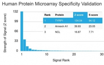 TYRP1 Antibody / Tyrosinase-Related Protein-1 / TRP1