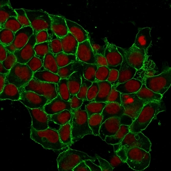 EpCAM Antibody / Extracellular domain