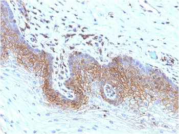 Recombinant Beta-2 Microglobulin Antibody