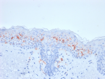 Recombinant CD1a Antibody
