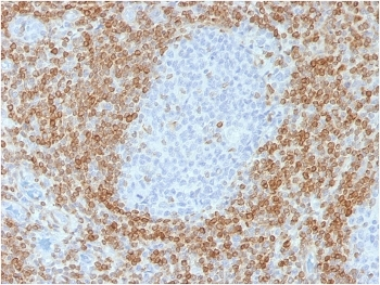 Recombinant Bcl2 Antibody