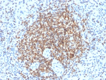Recombinant Bcl-2 Antibody / Rabbit Monoclonal