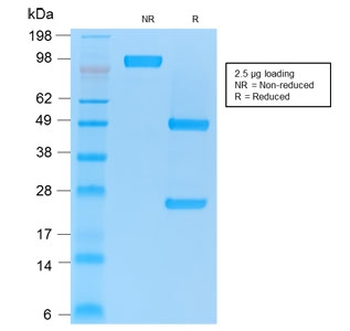 Recombinant CD86 Antibody