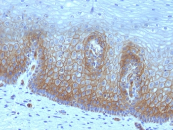 Recombinant Thrombomodulin Antibody / CD141
