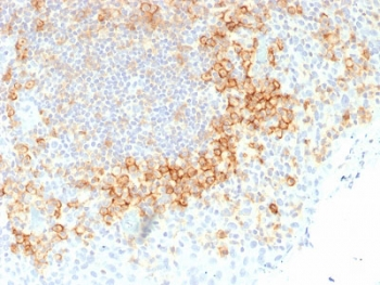 Recombinant CD27 Antibody
