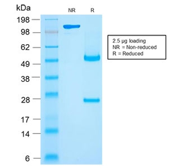 Recombinant CD27 Antibody