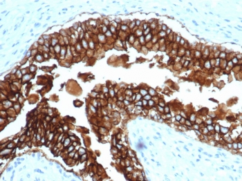 Recombinant EpCAM Antibody / Extracellular domain