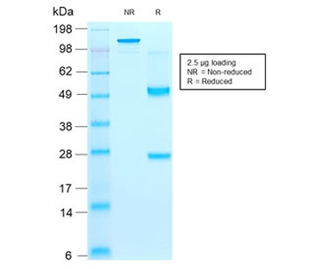 Recombinant CD44v9 Antibody