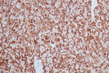 Recombinant HSP60 Antibody / Rabbit Monoclonal